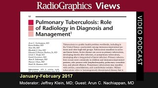 Pulmonary Tuberculosis Role of Radiology in Diagnosis and Management [upl. by Norej]