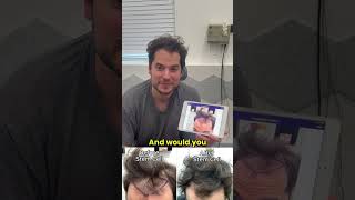 STEM CELL  PRP Therapy for Hair Loss with before and after photos [upl. by Agamemnon753]