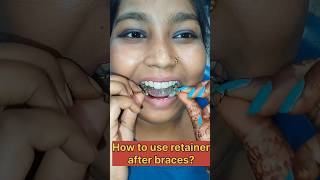 How to use retainer after braces  Retainer after braces treatment  Braces treatment  Sitamarhi [upl. by Khichabia]