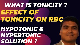 Tonicity and its effects on red blood cells  RBC  Hypertonic  Hypotonic  Isotonic  Hemolysis [upl. by Oilla]