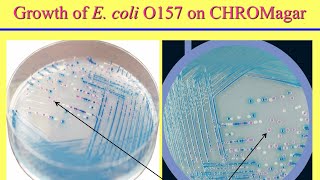 E coli ETEC amp EHEC Lesson Types amp Factors Part 1 Sketchy Medical  USMLE Step 1 [upl. by Proudman]