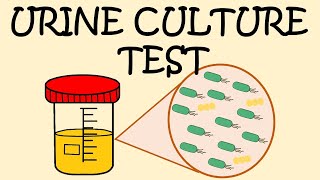 URINE CULTURE TEST  HOW TO COLLECT URINE SAMPLE [upl. by Ardnuhsor45]