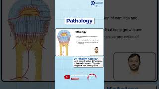 Pathology by Dr Faheem Kotekar  Orthopedic Residency  Conceptual Orthopedics [upl. by Dinerman833]