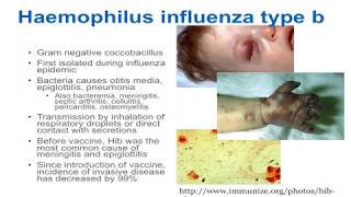 Poliomyelitis  Symptoms and Prevention [upl. by Aleafar849]