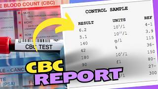 CBC Blood Test Results How to Read and Understand Your Results [upl. by Amabel]