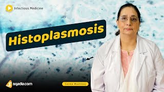 Histoplasmosis  Infectious Diseases Medicine Lecture  Medical School Student  VLearning [upl. by Glassman]