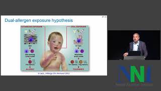 Atopic Dermatitis and Food Allergy Change of Concepts  Ralf Heine [upl. by Blaine775]