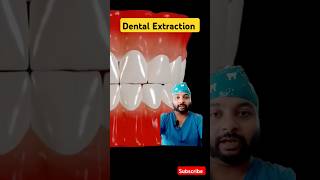 Animated Dental Extraction Procedure yt shorts ytvideodentist toothremoval extractionytshorts [upl. by Nosreve]